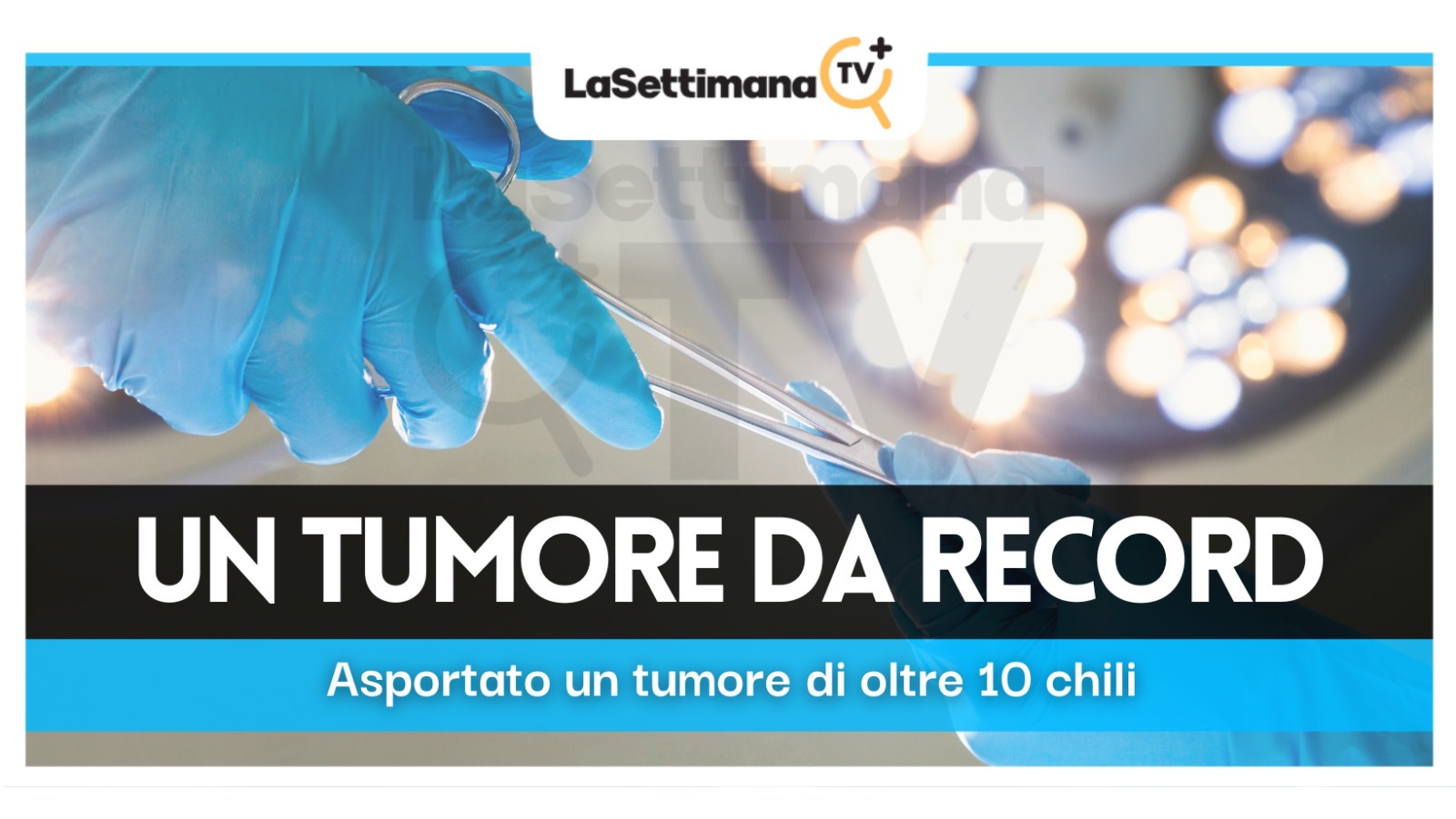 Asportato tumore di 10 chili